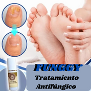 FUNGGY™ Tratamiento Antifúngico en Spray