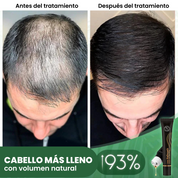 Regrowth™ Rodillo de Suero Capilar Orgánico
