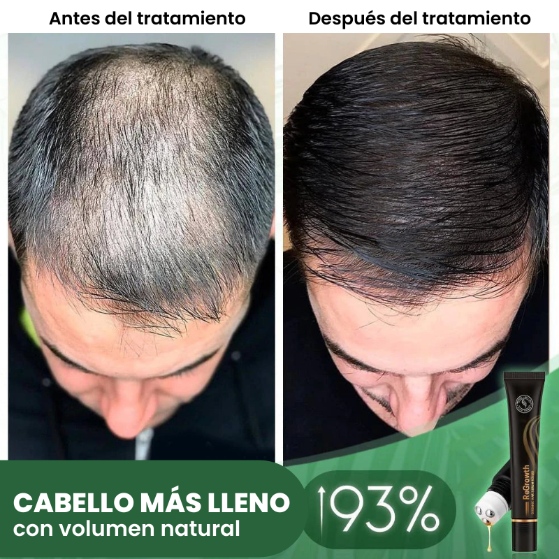 Regrowth™ Rodillo de Suero Capilar Orgánico
