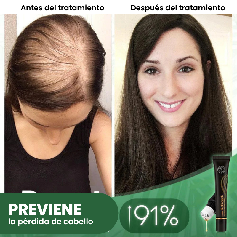Regrowth™ Rodillo de Suero Capilar Orgánico
