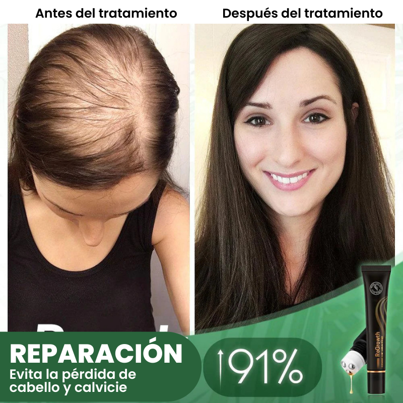 Regrowth™ Rodillo de Suero Capilar Orgánico